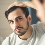 piel-sensible-condiciones-alopecia-maria-linda