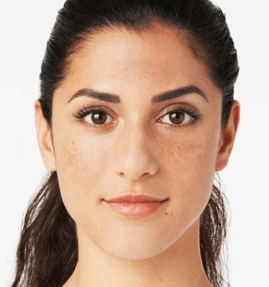 piel-sensible-melasma-manchas-maria-linda
